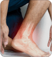 neuropathy